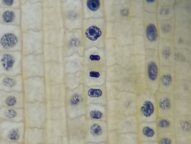 Onion Root Mitosis Slides - Onion Root  Mitosis  04 400X
